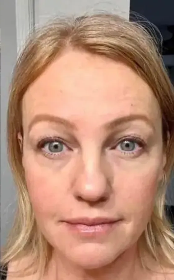 Customer's skin after using Activated Liquid Collagen